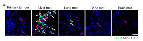 转入小鼠模子获得相同的试验效果，，，，且在转移爆发前NET已在肝脏聚积。。。。