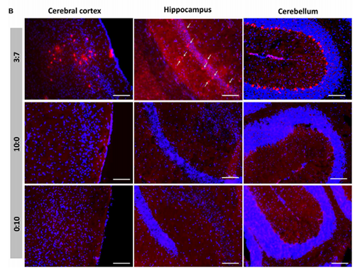 被包裹在含有NT-类脂质的LNP中的Cre重组酶乐成转移。。。。大脑中的转染神经元呈红色高亮。。。。