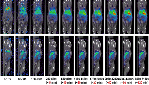 yl23455永利PET/CT分子影像手艺平台