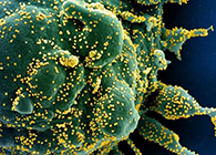 唾液检测新冠抗体新要领来了，，获取效果仅需几小时！