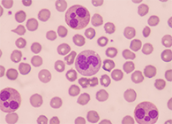 一种神秘颗粒被发明了！它能否成为败血症早筛标记物？？？？？？