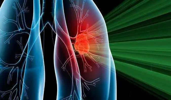 盛世泰科1类立异药物CGT-9475实现中美双报双批 | yl23455永利一站式临床宿世物医药研发效劳平台助力