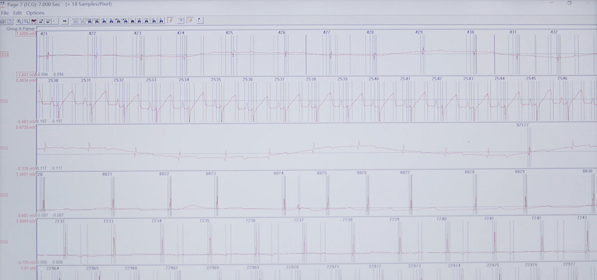 yl23455永利 SEND 数据转换平台