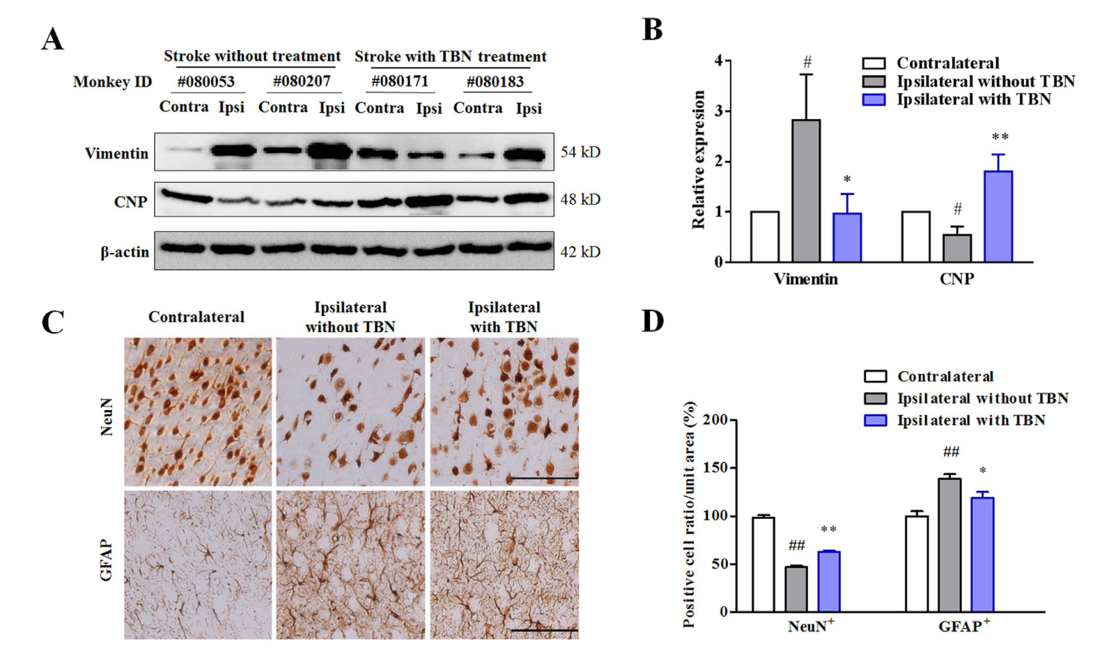 TBN是一种治疗缺血性卒中的新型临床候选药物，，，，，本研究中TBN通过yl23455永利合成